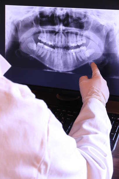 Best Root Canal Emergency Dentist  in Vley, AL