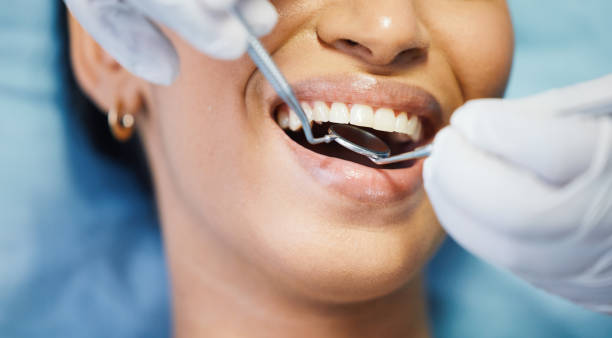 Best Broken Tooth Emergency  in Vley, AL
